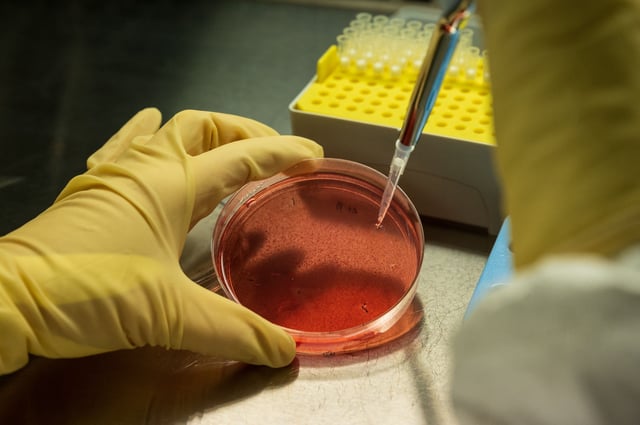 This photograph taken on November 17, 2021, shows a laboratory test at the Transgene biotech firm, which is working to develop a neoantigen cancer vaccine, in Illkirch-Graffenstaden, eastern France. Transgene is working on transforming viruses to produce tumour antigens, which will enable the immune system to activate itself by producing the appropriate response in patients with cancer or who are at risk of recurrence. (Photo by PATRICK HERTZOG / AFP) (Photo by PATRICK HERTZOG/AFP via Getty Images)