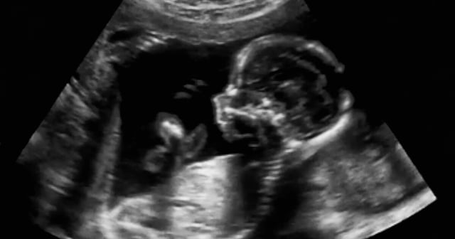 Scientists have treated an often fatal genetic condition in the womb for the first time