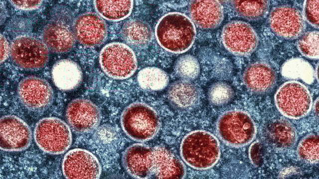 HKU5-CoV-2 shares similarities with COVID-19 as well as the virus that causes Middle East Respiratory Syndrome (MERS) (AP/File)