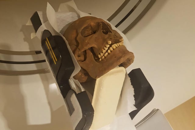 Pictured: The skull of a Viking-era individual, examined using modern X-Ray techniques.