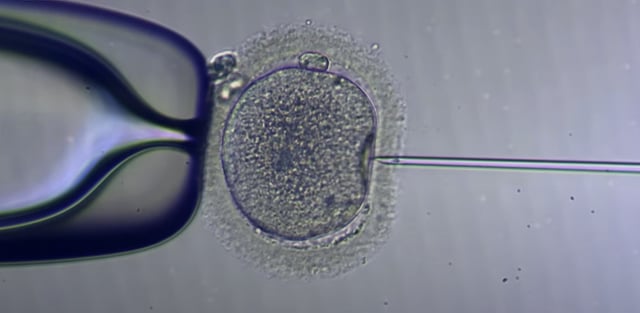 IVF process happening under a microscope
