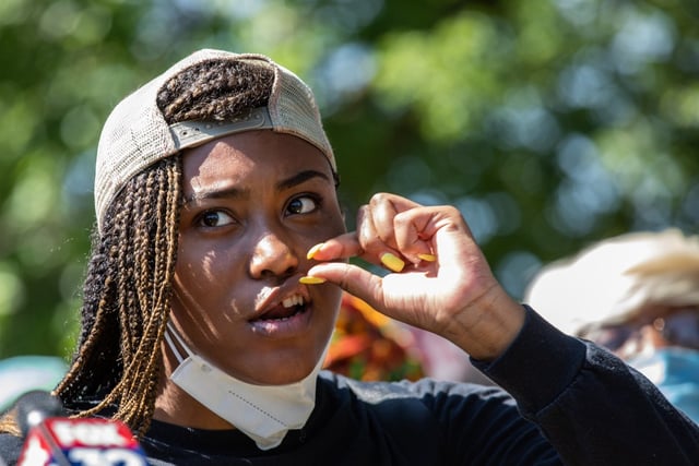 Miracle Boyd shows her broken teeth as she and members of Good Kids Mad City (GKMC) talk to reporters in Grant Park on July 20, 2020. Boyd shared her story about how she said she was unjustly targeted and attacked by a Chicago police officer at a Christopher Columbus statue protest a few days earlier. (Zbigniew Bzdak/Chicago Tribune)