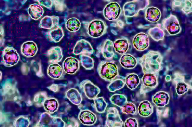 The measles virus, paramyxoviridae from the Morbillivirus family, transmission microscopy view. (Photo by: BSIP/Universal Images Group via Getty Images)