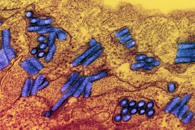 Colorized transmission electron micrograph of rabies virus particles (blue).