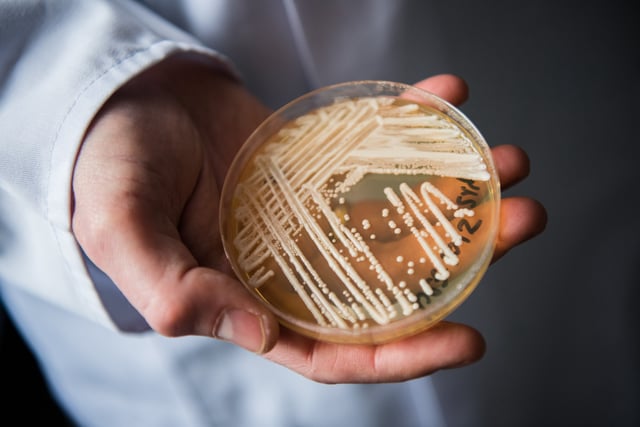 The director of the National Reference Centre for Invasive Fungus Infections, Oliver Kurzai, holding in his hands a petri dish holding the yeast candida auris in a laboratory of Wuerzburg University in Wuerzburg, Germany, 23 January 2018. There has been a recent rise of cases in Germany of seriously ill patients becoming infected with the dangerous yeast candida auris. 