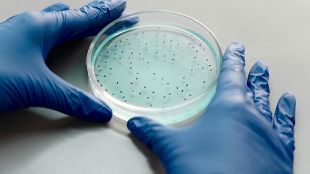 Deadly fungus C. auris is spreading rapidly in hospitals and nursing homes in the US