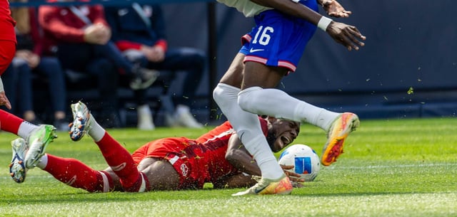 Alphonso Davies (unten) verletzte sich in einem sportlich unbedeutenden Spiel der kanadischen Nationalmannschaft gegen die USA
