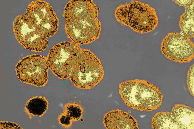 Neisseria gonorrhoeae