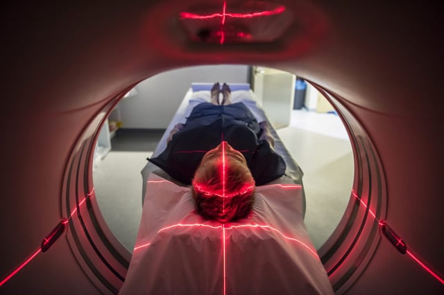 Do CT scans raise your risk of cancer? A new study weighs in.