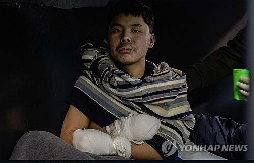 A wounded North Korean soldier, captured by Ukrainian forces, is seen in this file photo posted on Ukrainian President Volodymyr Zelenskyy's X account on Jan. 12, 2025. (PHOTO NOT FOR SALE) (Yonhap)
