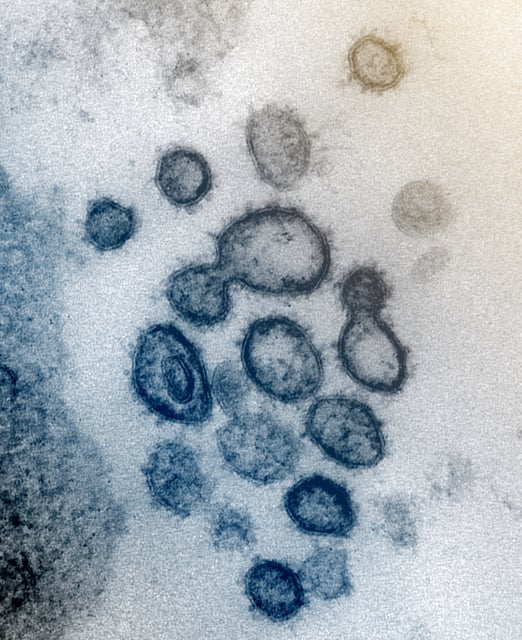This transmission electron microscope image shows SARS-CoV-2—also known as 2019-nCoV, the virus that causes COVID-19—isolated from a patient in the U.S. Virus particles are shown emerging from the surface of cells cultured in the lab. The spikes on the outer edge of the virus particles give coronaviruses their name, crown-like. Credit: NIAID-RML