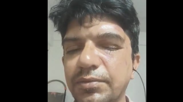 Bengaluru professor alleged that he was attacked by a group of men for asking them not to litter on roads. 