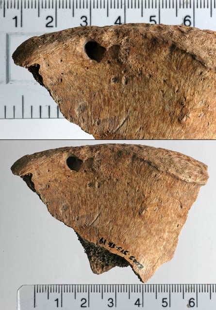 The lesions left behind by the carnivore show no signs of healing, suggesting they led to the man's death.