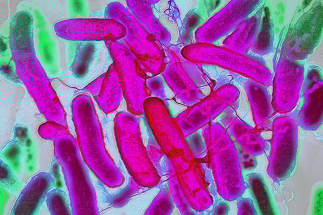 Escherichia coli that resides in the digestive tract of humans and warm-blooded animals.
