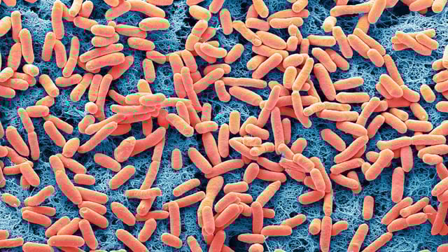 E.coli bacteria is part of a normal gut microbiome but some strains can produce toxins