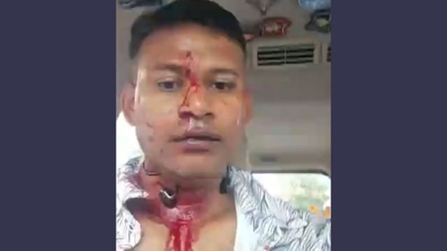 Wing Commander Shiladitya Bose shared a video on X in which he could be seen with blood on his face. (X)
