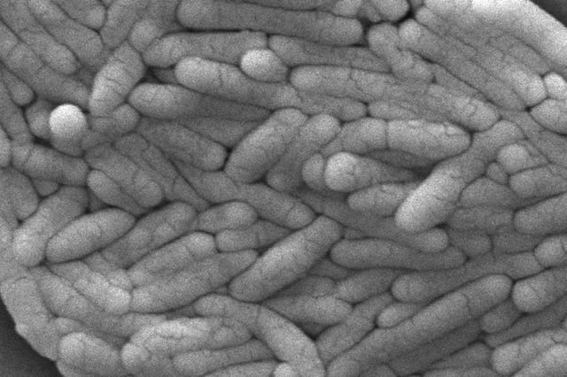 La bacteria Salmonella Typhi hallada en los estudios de laboratorio