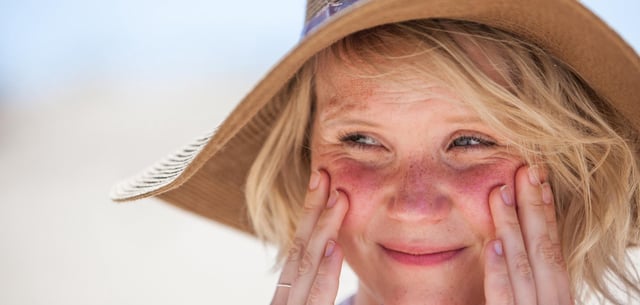 Schon an den ersten heiteren Tagen im Jahr ist Sonnenschutz wichtig