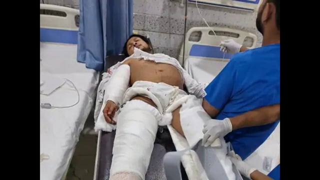 Injured Pawandeep undergoing treatment (HT Photo)