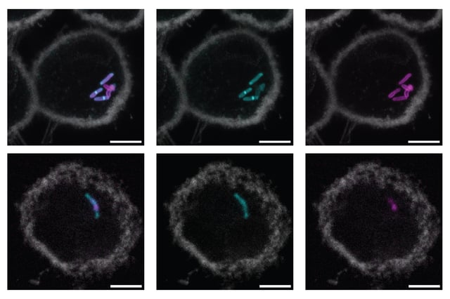 These macrophages are infected with mycobacterium tuberculosis. In the middle column, glycans in the bacterial cell wall have been labeled green. At right, bacterial cell walls are labeled in purple. The composite images at left show both the cell walls and the glycan label that the MIT team developed. Cells were imaged after 4 hours (top row) and 72 hours (bottom row).