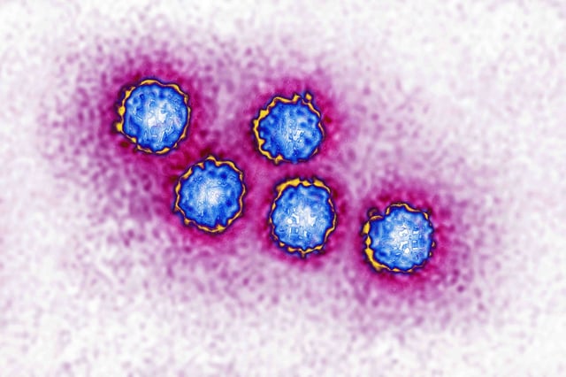 Hepatitis A virus (picornavirus). The HAV. almost always causes mild hepatitis. View produced from a transmission electron microscopy image. Viral diameter approximately: 30 nm. (Photo by: CAVALLINI JAMES/BSIP/Universal Images Group via Getty Images)