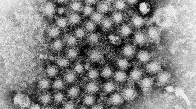 File photo: a microscope image made available by the U.S. Centers for Disease Control and Prevention shows a group of hepatitis virions, strain unknown.