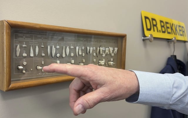 Dentist James Bekker points to his model of dissected human teeth while explaining the effects of removing fluoride from public drinking water, April 30, 2025, at his office in Salt Lake City, Utah. (AP Photo/Hannah Schoenbaum)