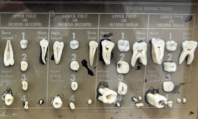 Dissected human teeth are displayed in the office of dentist Dr. James Bekker, April 30, 2025, in Salt Lake City, Utah. (AP Photo/Hannah Schoenbaum)