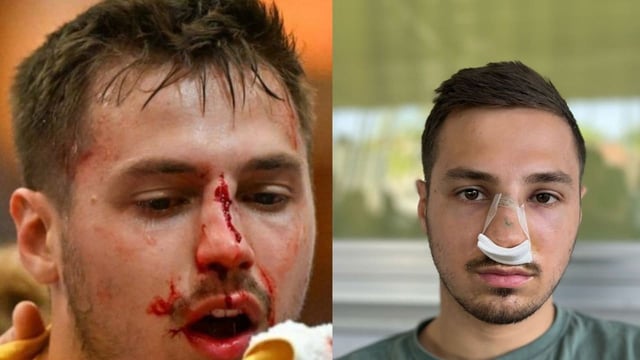 In der 1.  Handball-Liga Österreichs wurde ein Spieler für über zwei Jahre gesperrt.