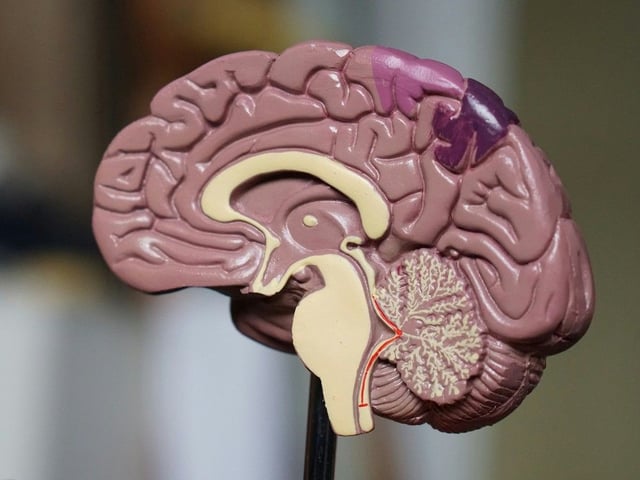 Many patients display symptoms of Alzheimers, but only by examining the brain after death can that be 100 per cent determined by viewing the damage. Neurological science has come far, but has unique challenges too. 