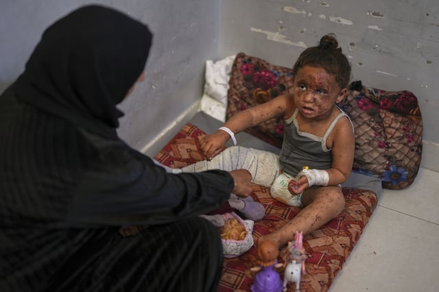 Raika Abu Sahloul, 40, cares for her 4-year-old niece, Layan, as she sits despondently among her dolls at Nasser hospital with second-degree burns on her face, foot, and stomach, caused a week earlier during an Israeli army strike on her home in Khan Younis that killed her pregnant mother and two siblings and buried her under the rubble, in Khan Younis, Gaza Strip, Sunday, May 4, 2025.(AP Photo/Abdel Kareem Hana)