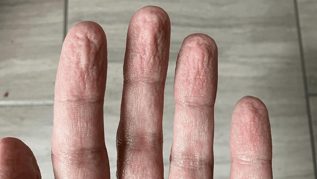 When You Get Your Fingers Wet They Wrinkle In The Same Pattern Every Time