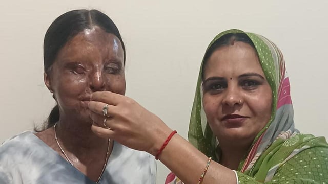 Kafi, an acid attack survivor and a visually impaired student, scored 95.6% in the CBSE Class 12 exams. (HT Photo)
