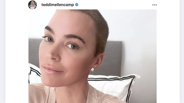 Teddi Mellencamp talks hair regrowth.