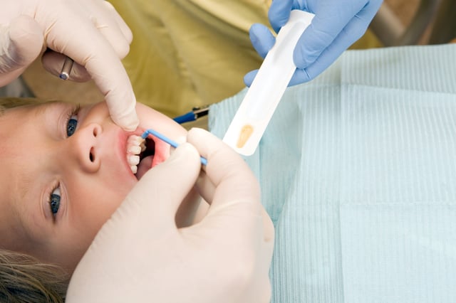 Fluoride application at the dentist