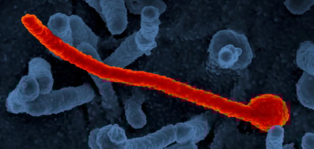 Ebola-Virus unter dem Elektronenmikroskop