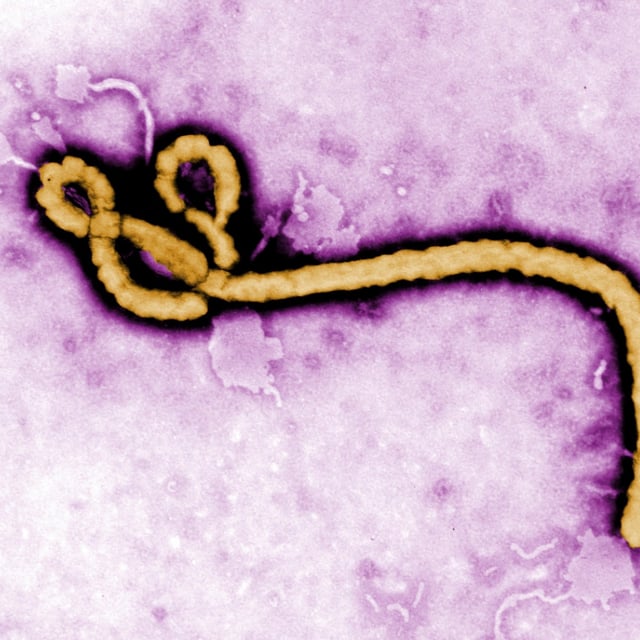 Das Ebola-Virus unter einem Mikroskop: Ein Mann in Tschechien wurde nun mit Verdacht darauf in eine Klinik in Tschechien eingeliefert.