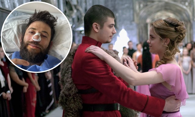 Stanislav Yanevski, pictured with Emma Watson in &#39;Harry Potter and The Goblet of Fire&#39;, underwent emergency surgery (inset) after suffering a breathing problem. (Getty; Instagram / stan_yanevski)