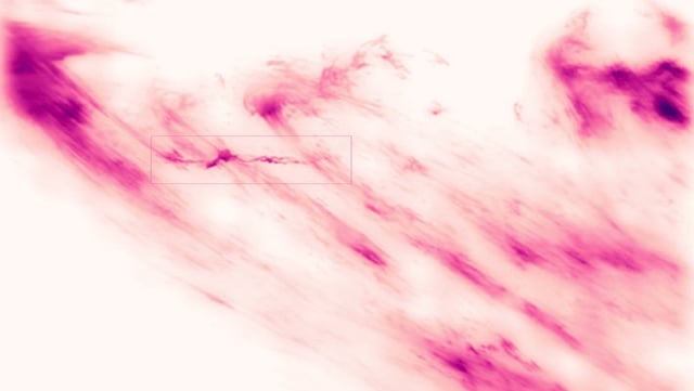 This image is a snapshot from a 16-minute time-lapse movie showing the formation and collapse of a complexly shaped plasma stream traveling at almost 100 km per seconds in front of a coronal loop system. This is likely the first time such a stream, which the scientists refer to as plasmoid, has been observed, leaving them wondering about the physical explanation of the observed dynamics. This image was taken by the Goode Solar Telescope at Big Bear Solar Observatory using the new coronal adaptive optics system Cona. The image shows the hydrogen-alpha light emitted by the solar plasma. The image is artificially colorized, yet based on the color of hydrogen-alpha light, and darker color is brighter light. Image credit: Schmidt et al. / NJIT / NSO / AURA / NSF.