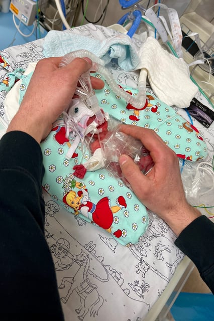 Das Foto von Marie kurz nach der Geburt wurde vom Krankenhaus veröffentlicht