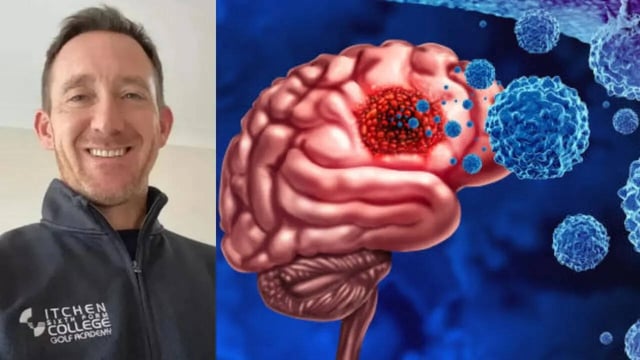 Man Dies Just Ten Days After He Was Diagnosed with a Killer Tumour