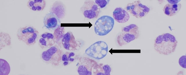 Microscope image of ameoeba