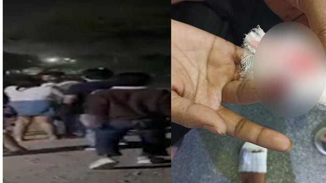 Group of boys assault 4 girls, drag them, bite off one's finger in Raipur
