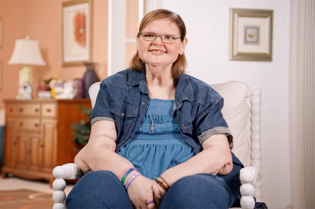 1000-Lb Sisters’ Tammy Slaton's skin removal surgery.