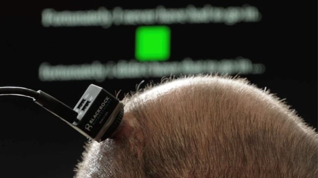 An investigational brain-computer interface (BCI) allows the study participant to communicate through a computer.