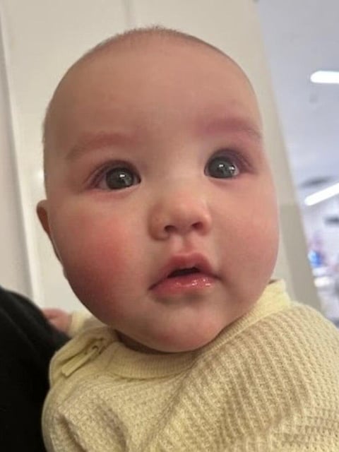 Her parents took the five-month-old to hospital, where doctors flushed the baby’s eyes.