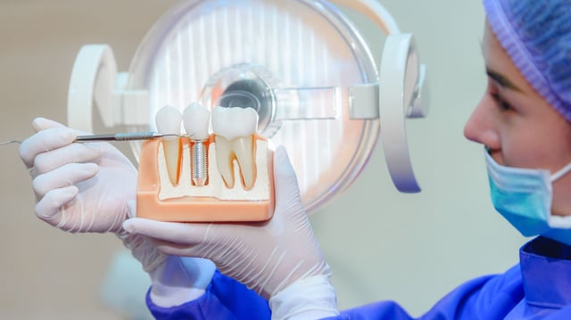 A dental professional in surgical gloves and mask points to a model showing a dental implant integrated with natural teeth, under a clinical examination light. The image visually represents the application of hydroxyapatite in bone and dental implants—contextualizing the article's focus on converting human urine into implant-grade materials using synthetic yeast.