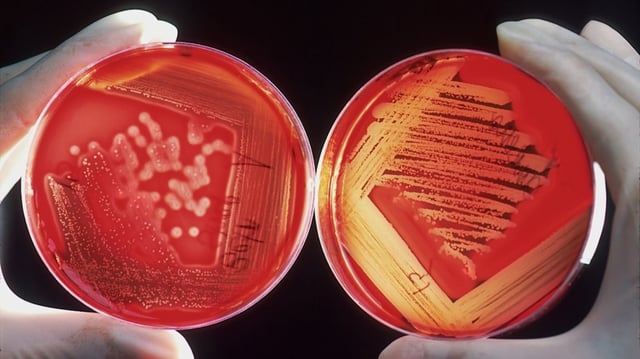Aspergillus Fumigatus, a deadly fungus, is spreading in the US, here's how to protect yourself