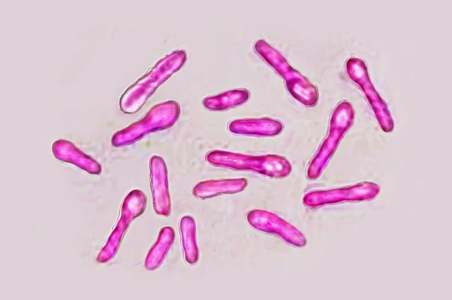 Clostridium botulinum bacteria (botulism bacillus). This bacteria secretes a very powerful toxin (botox), which inhibits the motor neurons of muscle contraction. Image taken from an X 1000 optical microscopy. (Photo by: CAVALLINI JAMES/BSIP/Universal Images Group via Getty Images)