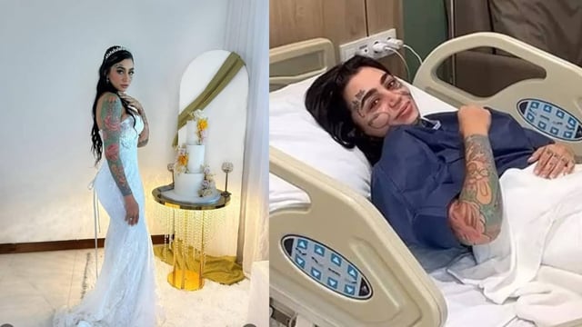 Turkey, Cosmetic Surgery   | Image: Instagram 